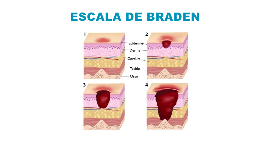 escala de Braden