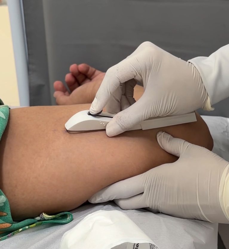 Capacitação de enfermeiros para inserção de DIU e de Implanon